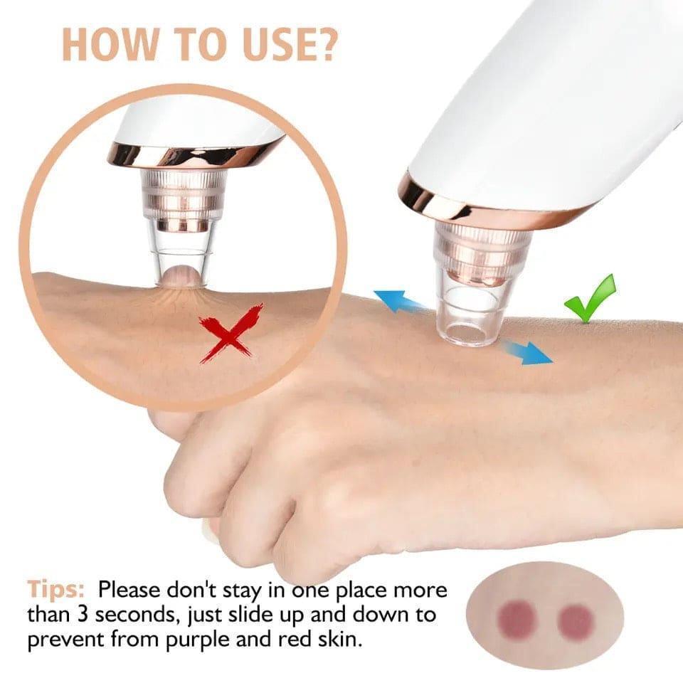 5 In 1 Black Head Remover Machine