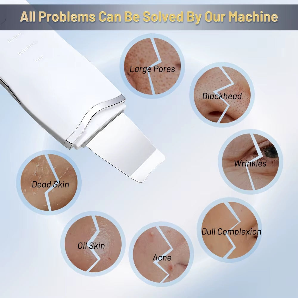 Ultrasonic Facial Scrubber