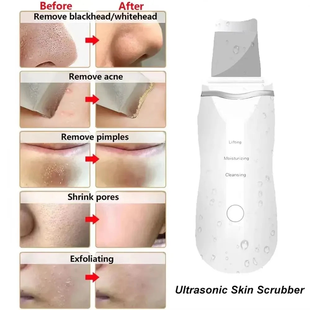 Ultrasonic Facial Scrubber