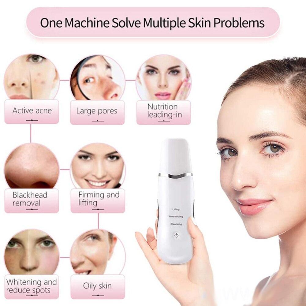 Ultrasonic Facial Scrubber